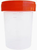 VASO ESTÉRIL PARA RECOLECCIÓN DE ORINA 100mL
